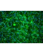 Mouse Schwann Cells (MSC) - Immunostaining for S100-β, 200x.
