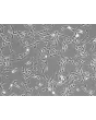 Rabbit Cardiac Fibroblasts (RabCF) – Phase Contrast, 100X.