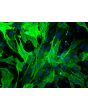 Rabbit Renal Mesangial Cells (RabRMC) – Immunostaining for &alpha;-sma