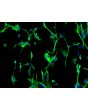 Rat Astrocytes-Midbrain (RA-mb)- Immunostaining for GFAP, 200x