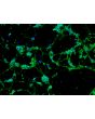 Rat Cerebellar Granule Cells (RGC) - Relief contrast