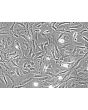 Rat Embryonic Fibroblasts (REF) - Phase contrast, 200x.
