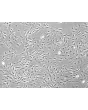 Rat Hepatic Stellate Cells (RHSteC) - Phase Contrast, 100x
