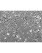 Rat Hepatic Stellate Cells-adult (RHSteC-a)-Phase contrast, 100x.
