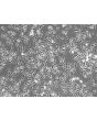 Rat Microglia (RM) - Phase contrast, 100x.
