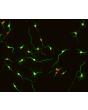 Rat Neurons-hippocampal (RN-h) - Relief contrast