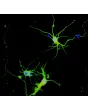 Rat Neurons-striatal (RN-s) - Immunostaining for β-Tubulin III (green) and S100-β, 400x.
