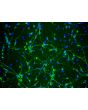 Rat Neurons-striatal (RN-s) - Immunostaining for &beta;-Tubulin III (green) and S100-&beta;