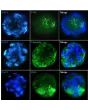 Immunostaining of the hepatic stellate cell-sinusoidal endothelial cell co-culture spheroids with the stellate cell markers (Vimentin and Smooth Muscle Actin) and the endothelial cell marker Von Willebrand Factor . 