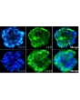 Day 7; Immunostaining of the hepatocyte-stellate cell co-culture spheroids with the hepatocyte markers such as albumin (ALB) and cytokeratin18 (CK18)
