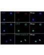 Immunostaining of human BBB spheroids with the endothelial cell marker VWF, the astrocyte marker GFAP, and the pericyte marker PDGF receptor β.
