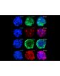 3D mini-kidneys display the epithelial cell marker CK18