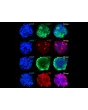 3D mini-kidneys display the epithelial cell marker CK18, the endothelial cell marker VWF, and the mesenchymal marker Vimentin. Notably, these spheroids also display high ACE2 expression.
