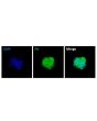 Human Ovarian Fibroblast Spheroids express the fibroblast marker fibronectin (FN)