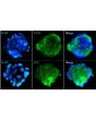 Immunostaining of the human pulmonary alveolar epithelial cell spheroids with the epithelial cell marker CK18 and the specific alveolar epithelial cell type II marker SP-C. 