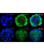 Immunostaining analysis of SP3D-HTMCS with the TM cell marker Myocilin (MYOC)