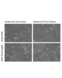 The bFGF Thermostable exhibits superior activity compared to native bFGF.  Native (left) bFGF and rhbFGFTS (right) solutions were stored at 4°C (unstressed) or 37°C (heat stressed) for 72 hours before being used to treat the HUVEC cell. 