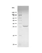 Recombinant yeast SUMO Protease fragment (4 ug) resolved on a 16% SDS-PAGE gel under reducing conditions and stained with Coomassie Brilliant Blue G-250
