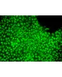 hESC growth in STEMium – Immunostaining for NANOG (green), 200x.
