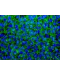 hiPSC grown in STEMium – Immunostaining for SSEA4 (green), DAPI (blue), 400x.
