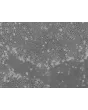 hESC growth in STEMium – phase contrast, 100x.
