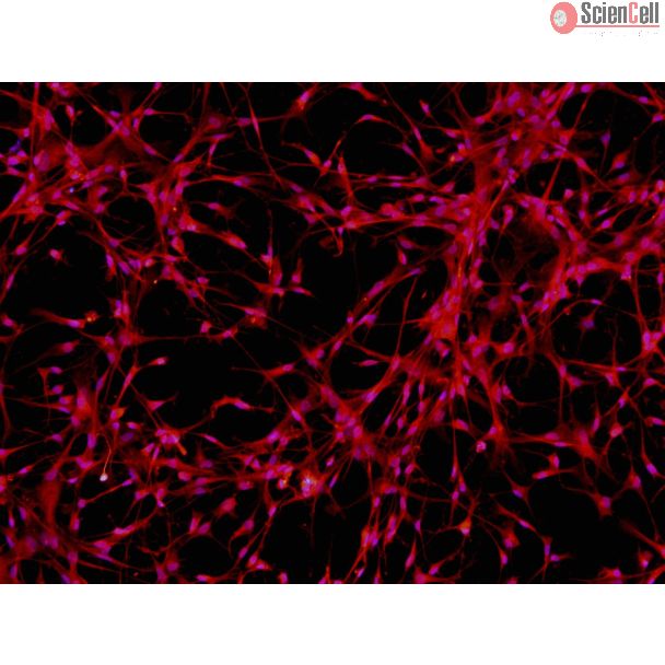 人多能干细胞衍生星形胶质细胞（H9-A）- GFAP免疫染色，100x。