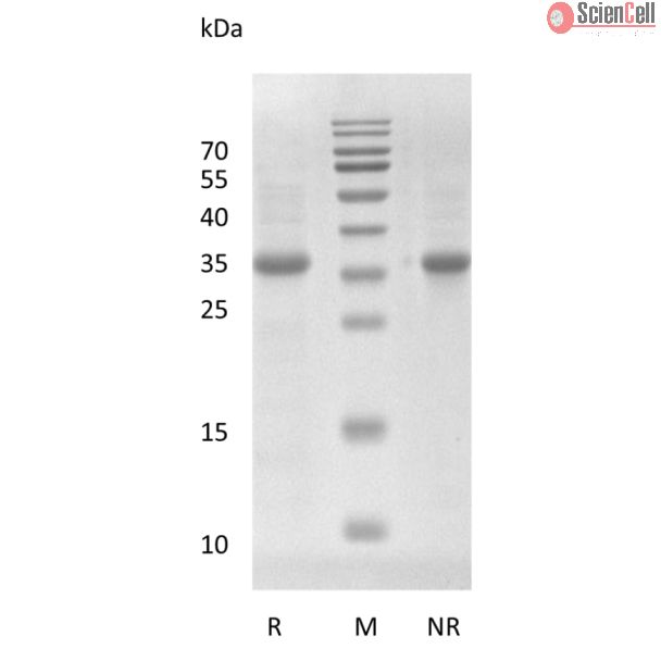 重组人 Wnt-3a 蛋白，来源于大肠杆菌（E. coli）