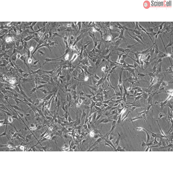 C57BL/6 小鼠小脑星形胶质细胞（MA-c）— 相差显微镜图像，100 倍放大
