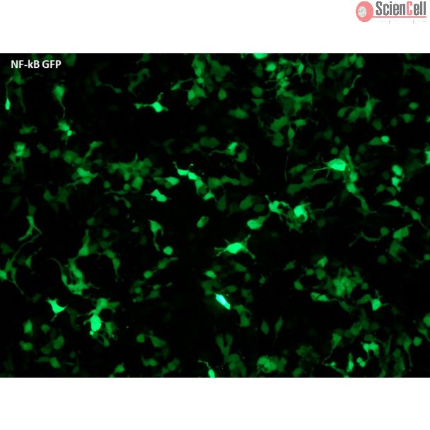 NF-κB GFP报告载体转染HEK293T细胞并激活信号通路后GFP的表达情况（100倍放大）