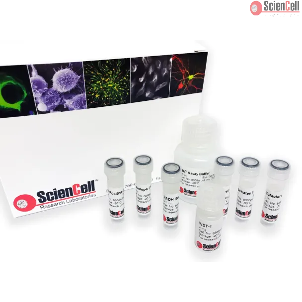 Colorimetric Histone Acetyltransferase Activity Assay