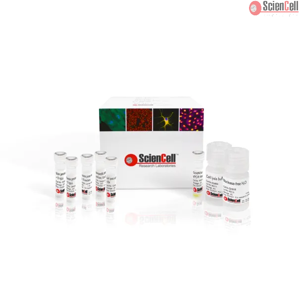 GeneQuery™ Human Biological Sex Determination qPCR Assay Kit (HSDQ)