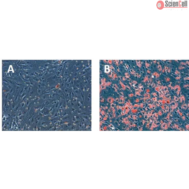 Hepatocytes were either left untreated (A) or treated with 200 μM oleic acid (B). The treated cells exhibited a significant accumulation of lipid droplets, as evidenced by the abundant presence of red dots observed through Oil Red O staining(B).