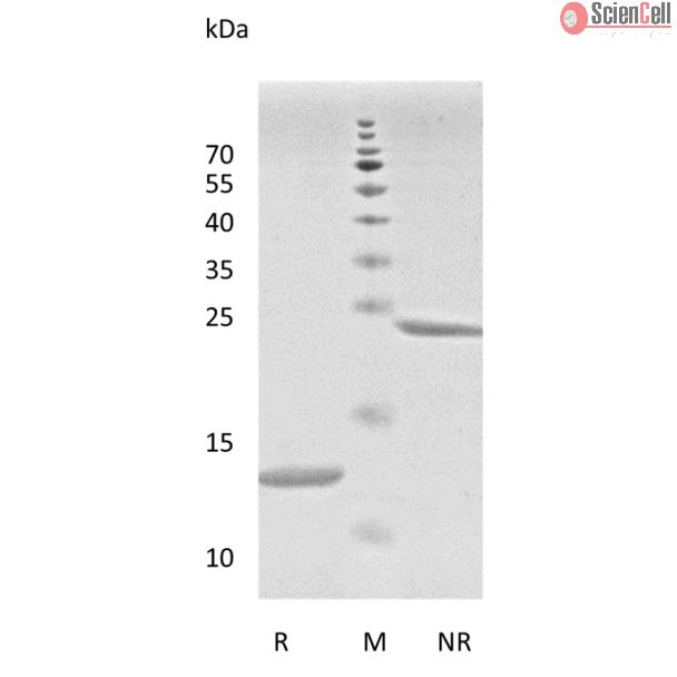 Recombinant Human Transforming Growth Factor-β1 