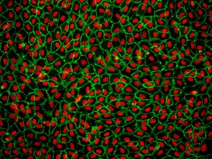 Immunostaining for CD31. Primary cells