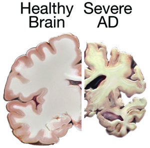 Image courtesy of the National Institute on Aging/National Institutes of Health