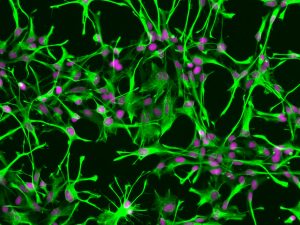 ScienCell's Human Astrocytes (HA) - Immunostaining for GFAP, 200x.