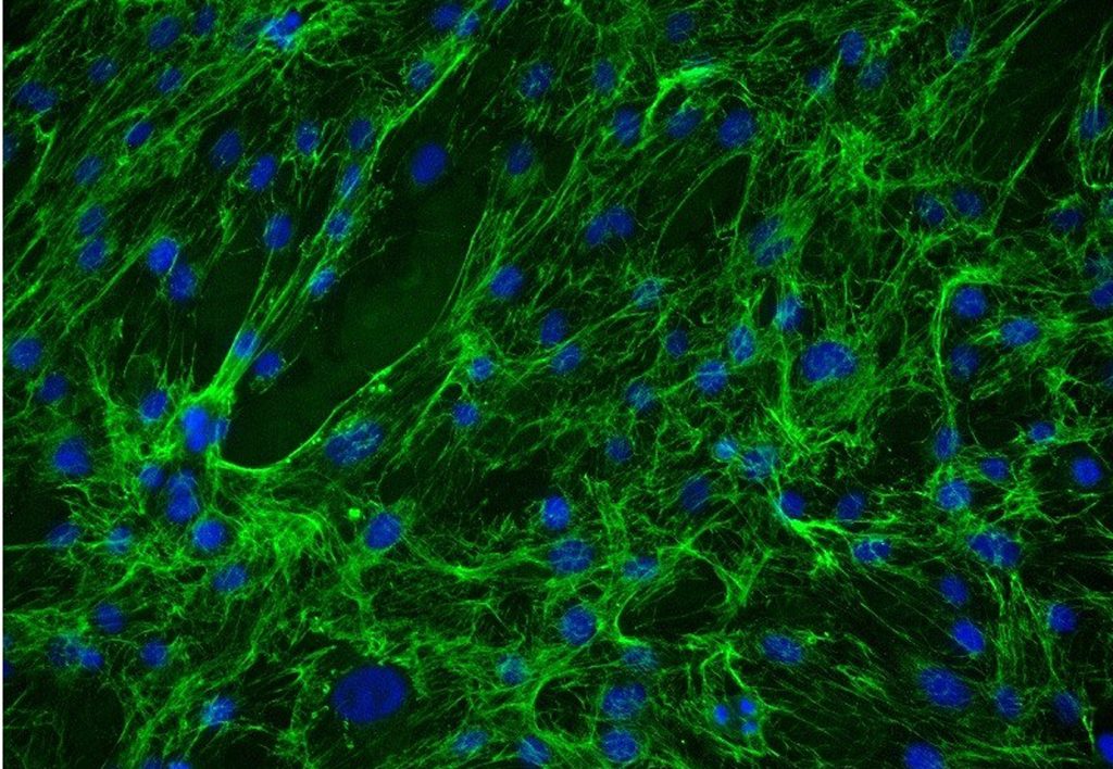 ScienCell's Human Mammary Fibroblasts (HMF) - Immunostaining for Fibronectin, 200x.