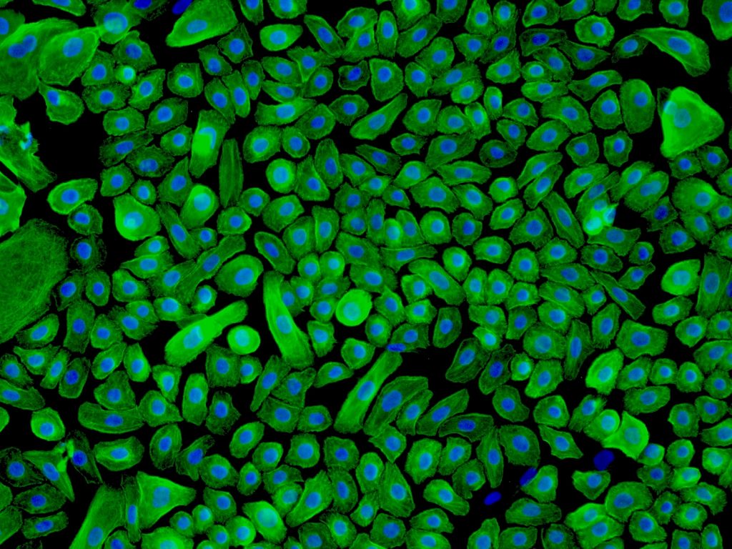 Human Epidermal Keratinocytes-neonatal (HEK-n) - Immunostaining for CK-18, 200x.