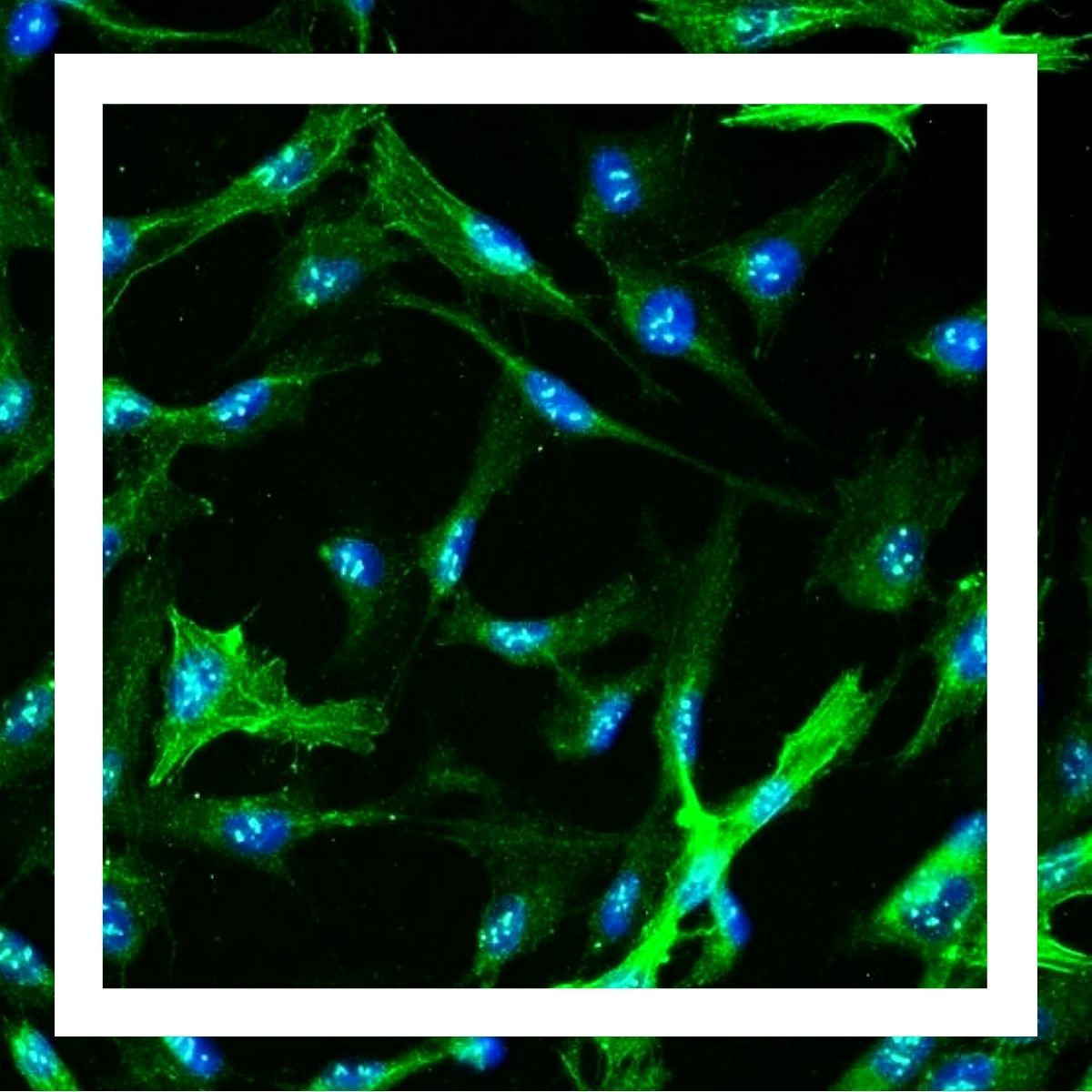 Human Hepatic Stellate Cells