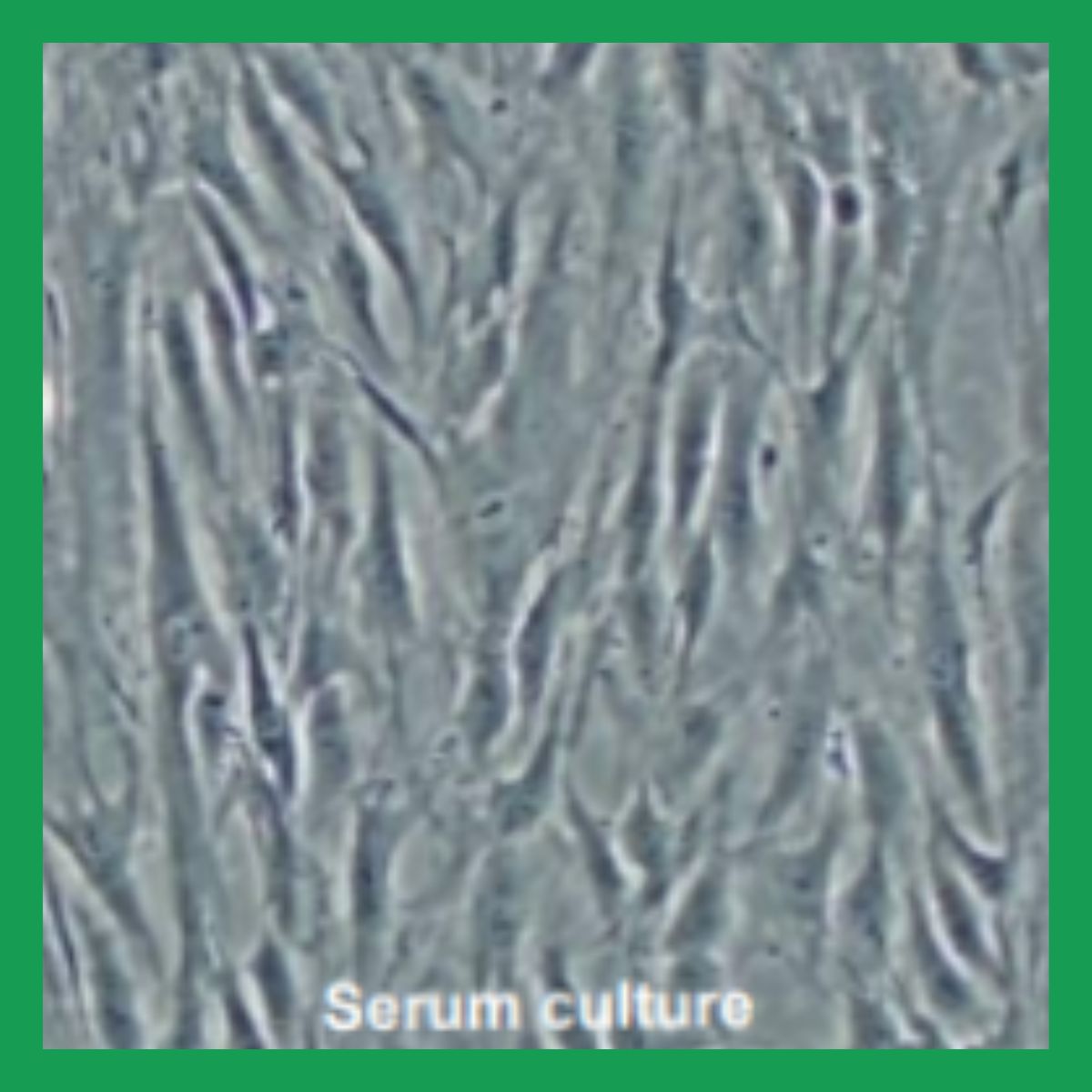 Serum Culture