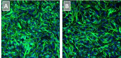 Figure 2. Neural Stem Cells Cultured in Neural Stem Cell Expansion Medium Show Minimal Spontaneous Neuronal Differentiation Figure 2. Neural Stem Cells Cultured in Neural Stem Cell Expansion Medium Show Minimal Spontaneous Neuronal Differentiation