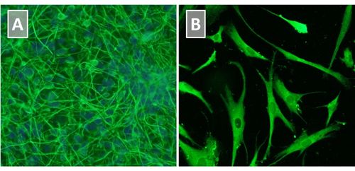 Figure 3. Neural Stem Cells Maintained in Neural Stem Cell Expansion Medium can Differentiate into Neurons and Astrocytes Figure 3. Neural Stem Cells Maintained in Neural Stem Cell Expansion Medium can Differentiate into Neurons and Astrocytes